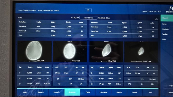 Abbildungsfehler Höherer Ordnung können mit dem Rodenstock-DNEye-Scanner gemessen werden und bei der Glasfertigung berücksichtigt werden.
